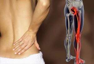 Back and Hip Pain Anatomy 